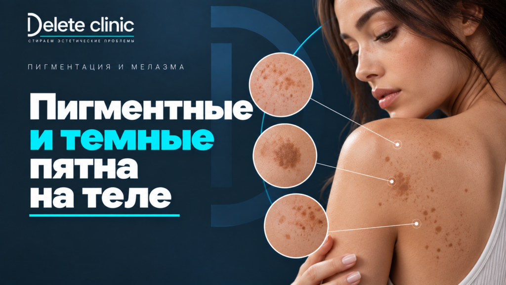 Пигментные и темные пятна на теле