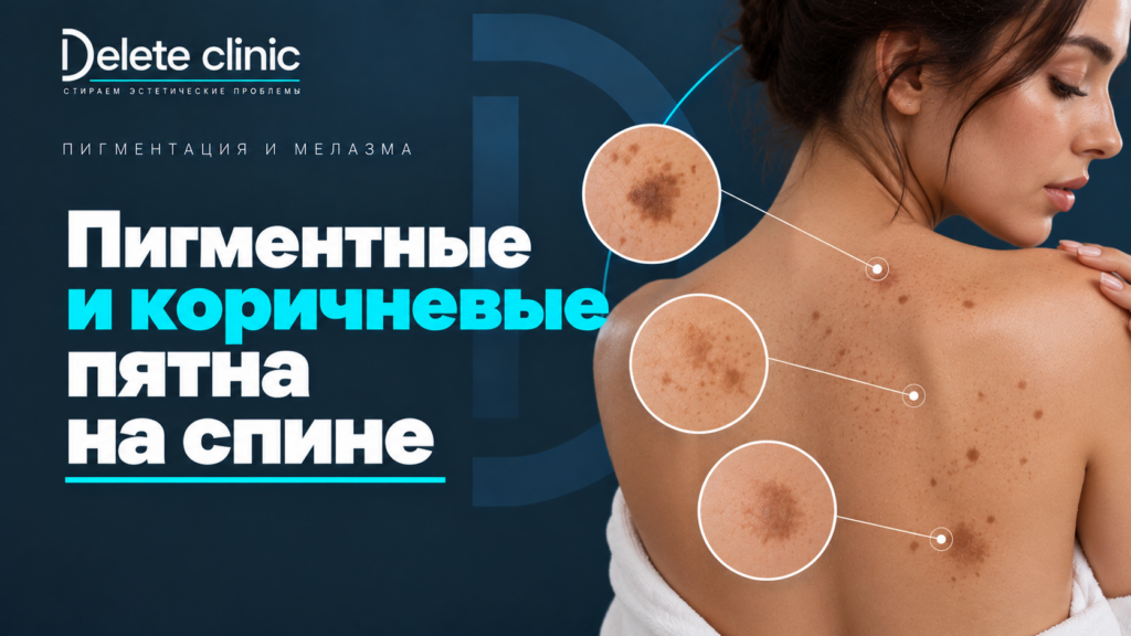 Пигментные и коричневые пятна на спине