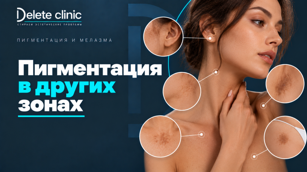 Пигментация в зонах: шея, живот, голова, бикини, губы, вокруг глаз