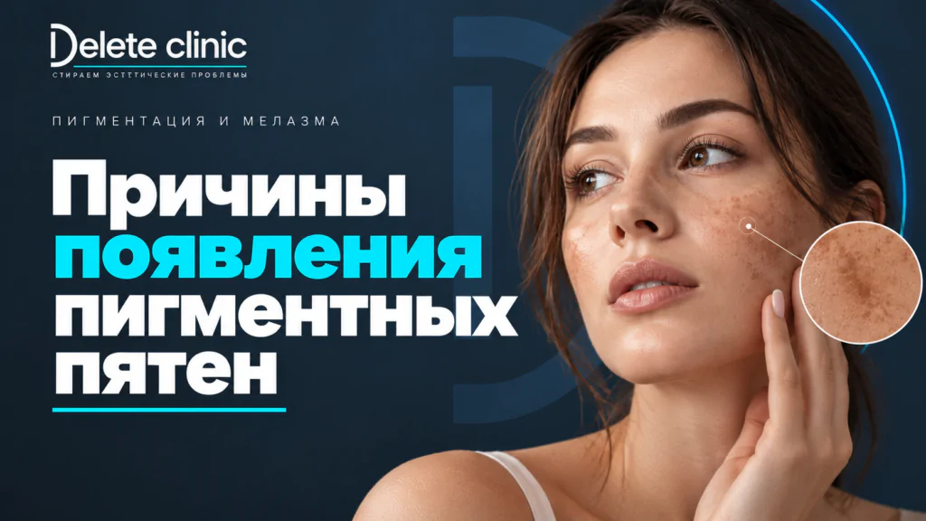 Причины появления пигментных пятен на коже и лице