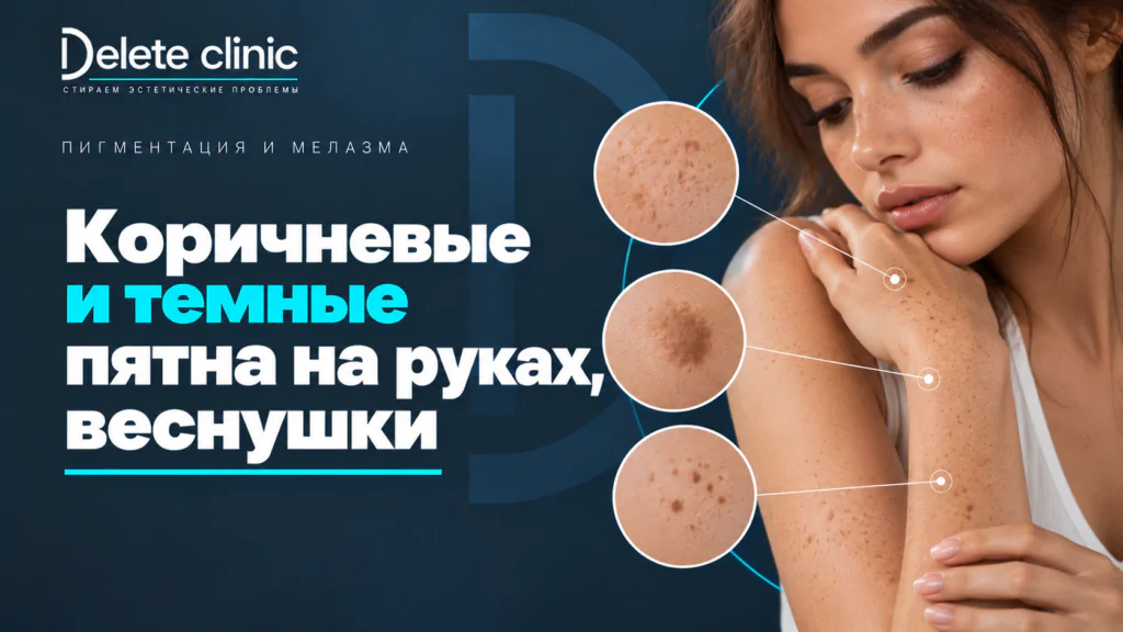 Коричневые и темные пятна на руках, веснушки